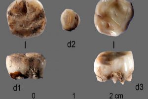 Researchers found 2 childrens milk teeth in north eastern Siberia