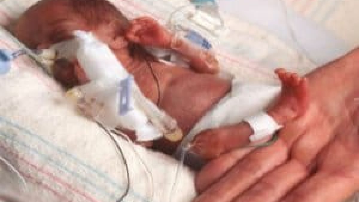 The Worlds smallest baby, weighing 245 grams