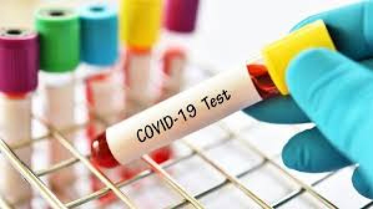 CDSCO approves 67 Indian firms for antibody rapid testing kits