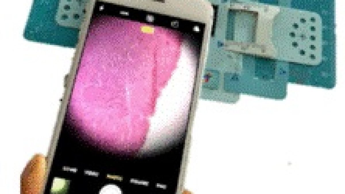 Foldscope could be a better alternative to clinical microscope