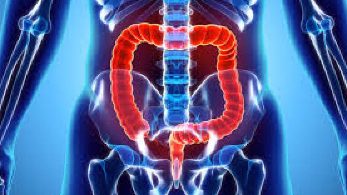 Body fluids can provide clue for early detection of colon cancer