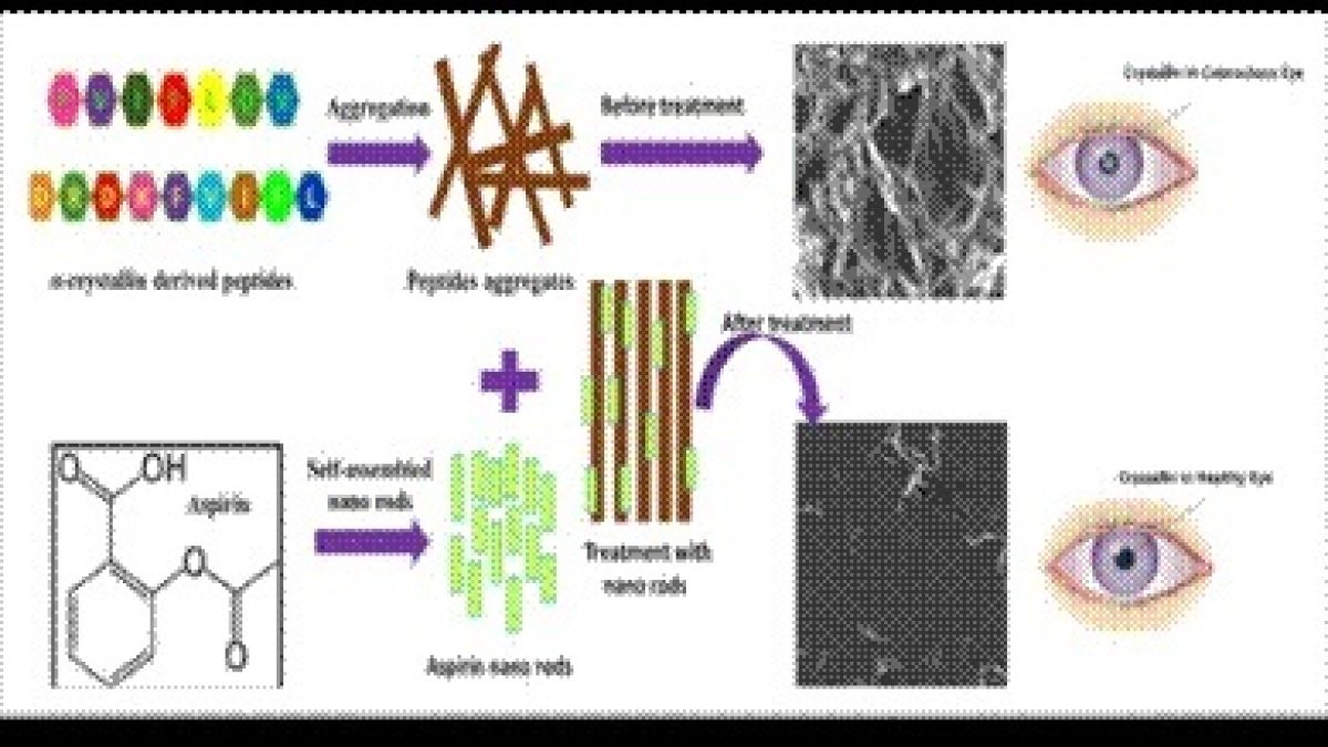 INST scientists develop simple economical nonsurgical prevention of cataract