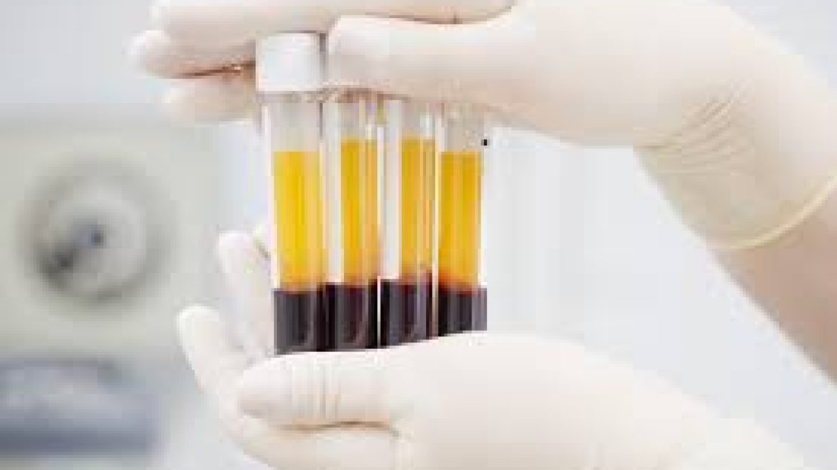 FDA announced emergency authorization of blood plasma treatment