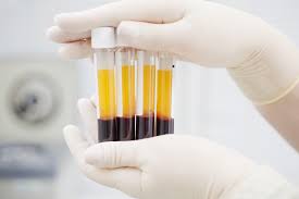 FDA announced emergency authorization of blood plasma treatment