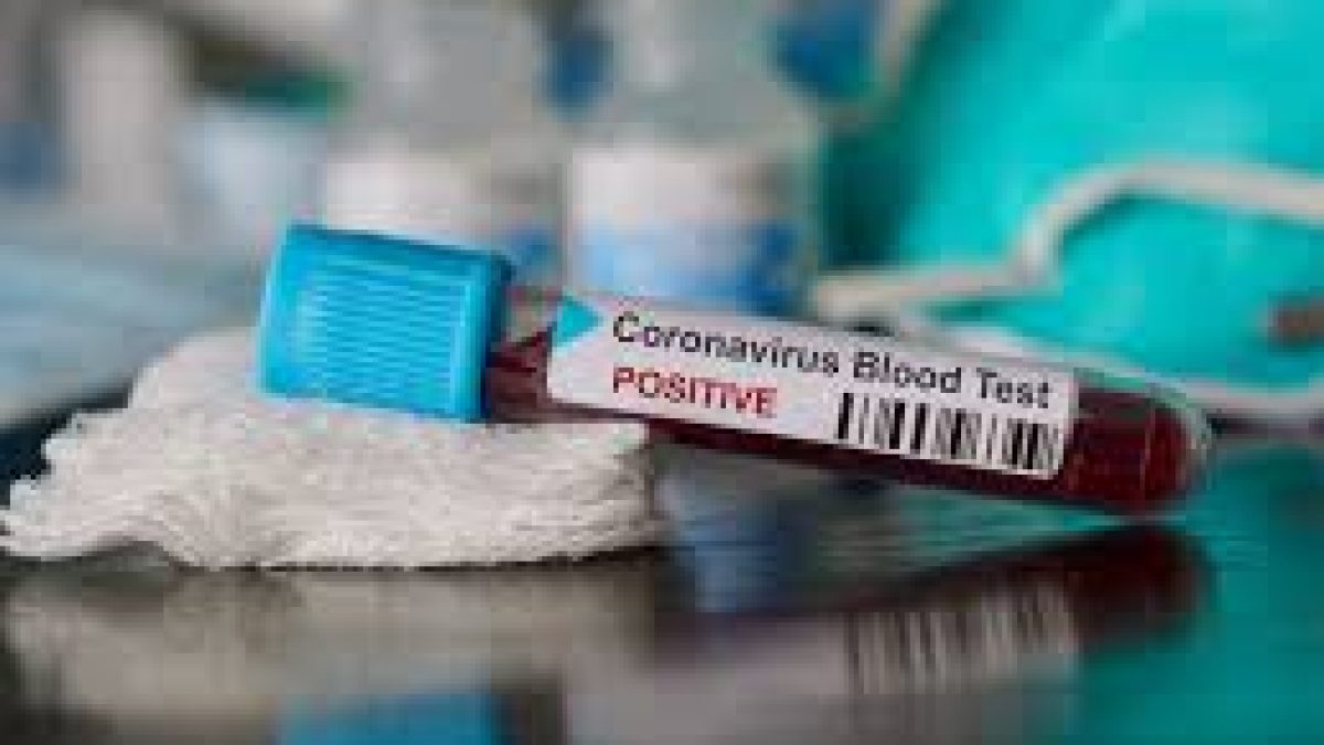 AA plus COVID-19 testing solution to detect coronavirus