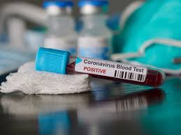 AA plus COVID-19 testing solution to detect coronavirus