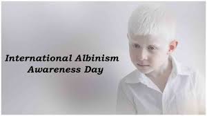 International Albinism Awareness Day 2020