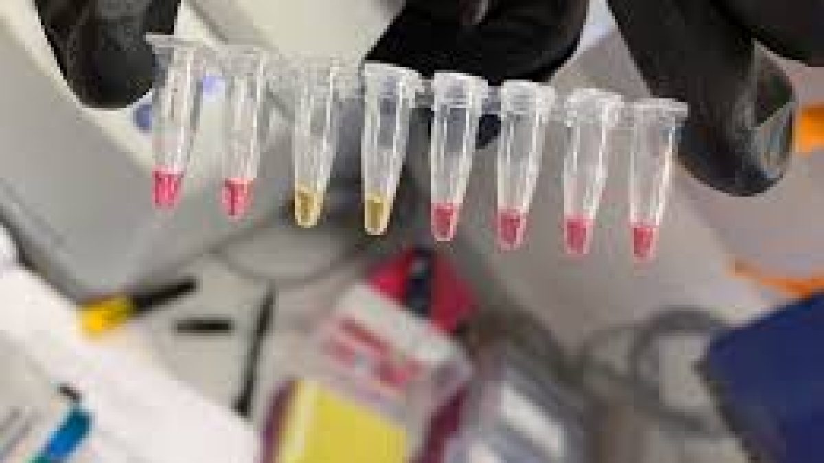 RT-LAMP based test for Coronavirus