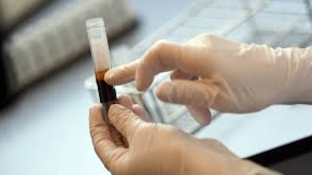 The plasma therapy debate