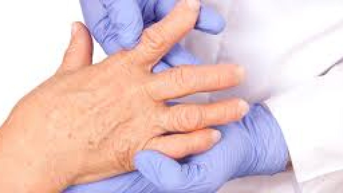 World Arthritis Day 2020