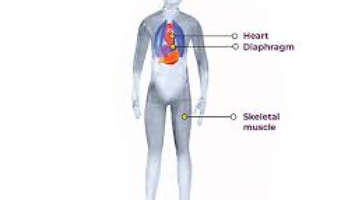 Duchenne Muscular Dystrophy