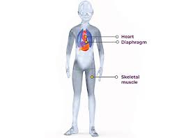 Duchenne Muscular Dystrophy