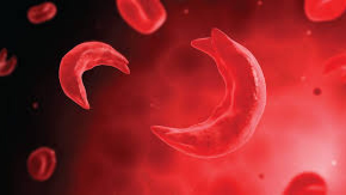 World Sickle Cell Day 2021