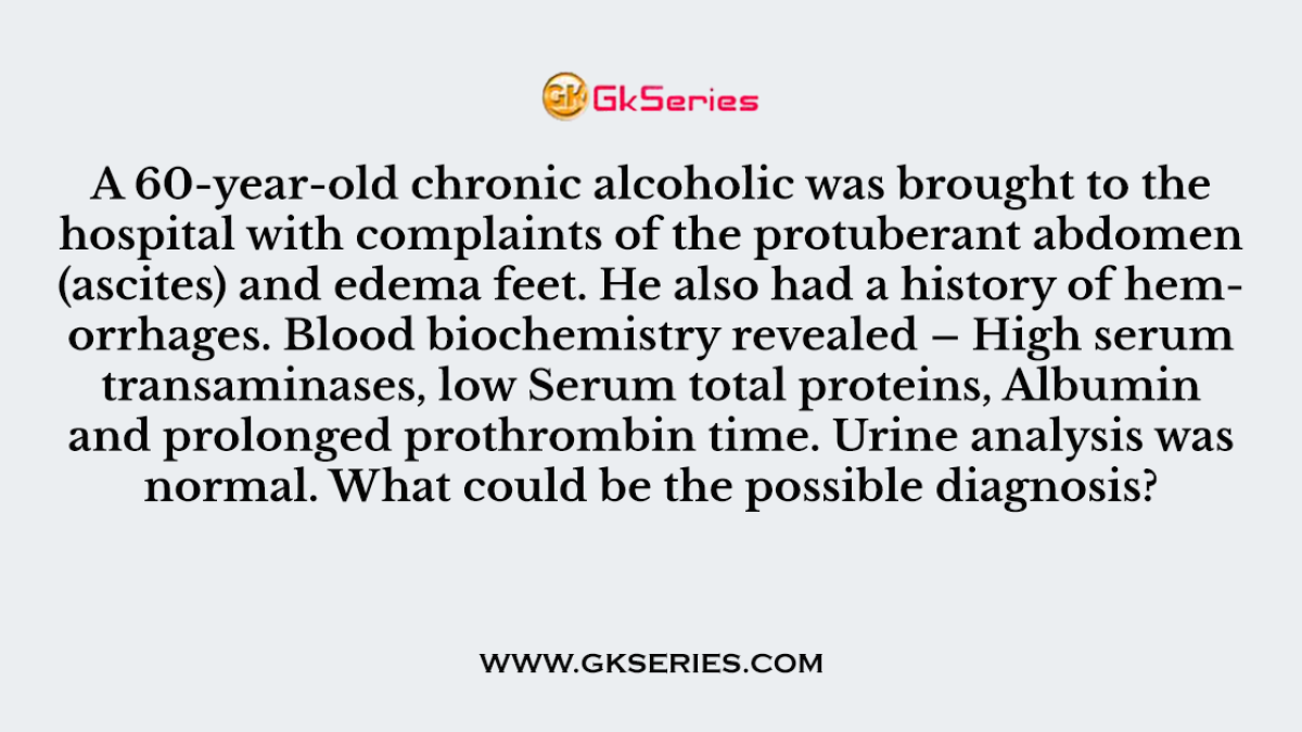 Q. A 60-year-old chronic alcoholic was brought to the hospital with complaints of the protuberant abdomen (ascites) and edema feet. He also had a history of hemorrhages. Blood biochemistry revealed – High serum transaminases, low Serum total proteins, Albumin and prolonged prothrombin time. Urine analysis was normal. What could be the possible diagnosis?