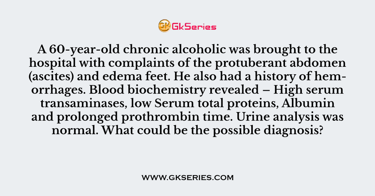 Q. A 60-year-old chronic alcoholic was brought to the hospital with complaints of the protuberant abdomen (ascites) and edema feet. He also had a history of hemorrhages. Blood biochemistry revealed – High serum transaminases, low Serum total proteins, Albumin and prolonged prothrombin time. Urine analysis was normal. What could be the possible diagnosis?