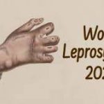 World Leprosy Day 2022: 30 January