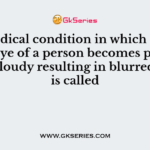 The medical condition in which the lens of the eye of a person becomes progressively cloudy resulting in blurred vision is called