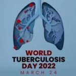 World Tuberculosis Day 2022: 24 March