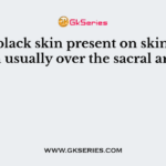 Bluish black skin present on skin of new born usually over the sacral area is