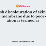 Bluish discolouration of skin and mucous membrane due to poor oxygenation is termed as