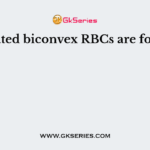 Nucleated biconvex RBCs are found in
