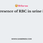 Presence of RBC in urine is