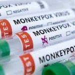 Monkeypox Disease Name Changed to Mpox by WHO