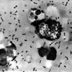 Bubonic Plague Cases Detected in China’s Inner Mongolia: Authorities Respond Swiftly