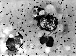 Bubonic Plague Cases Detected in China’s Inner Mongolia: Authorities Respond Swiftly