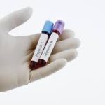 India Ranks Second in Hepatitis B and C Cases Worldwide