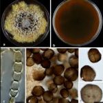 BHU Discovers New Phytopathogenic Fungus, Epicoccum indicum