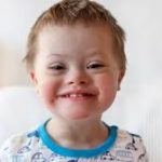 Down Syndrome