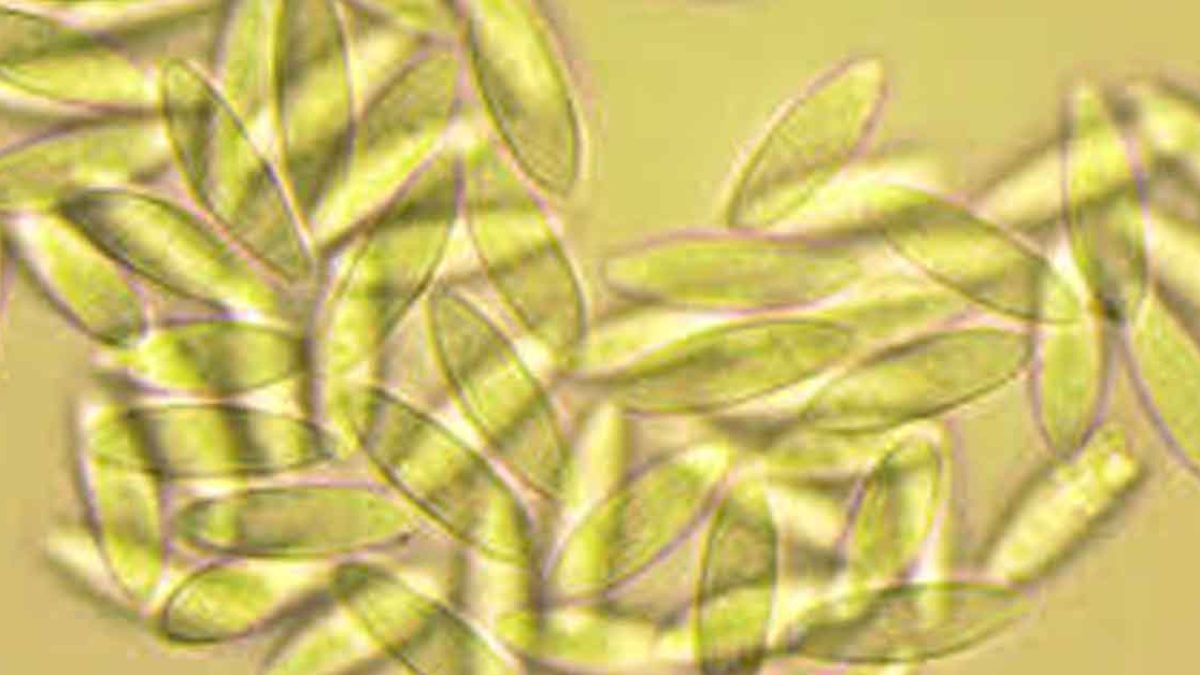 Parasynnemellisia khasiana — Unique Fungal Discovery in the Khasi Hills