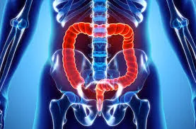 Body fluids can provide clue for early detection of colon cancer