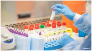 SCTIMST launched Agappe Chitra Magna