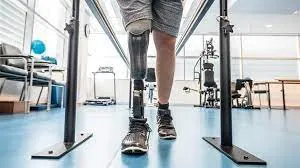 ISRO develops microprocessor-controlled smart limbs