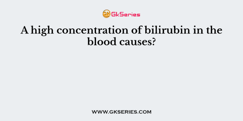 A high concentration of bilirubin in the blood causes?