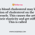 Which of following in the body’s largest blood vessel?
