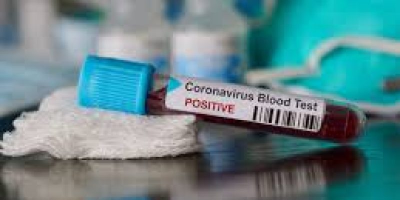AA plus COVID-19 testing solution to detect coronavirus