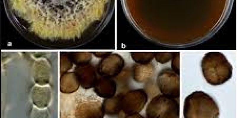 BHU Discovers New Phytopathogenic Fungus, Epicoccum indicum