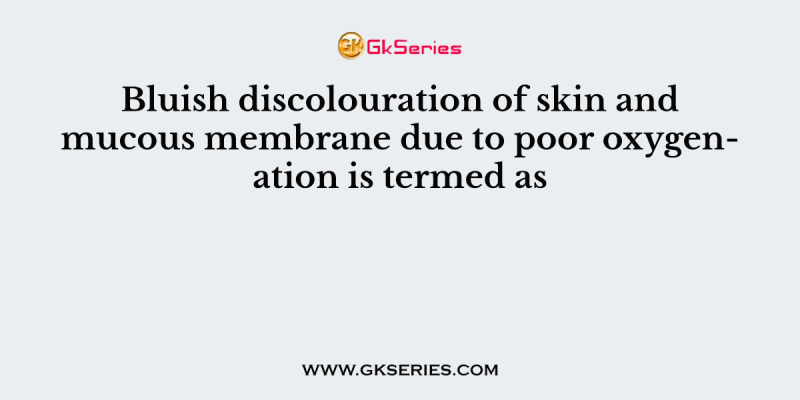 Bluish discolouration of skin and mucous membrane due to poor oxygenation is termed as