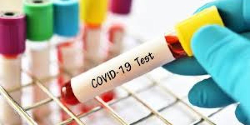 CDSCO approves 67 Indian firms for antibody rapid testing kits