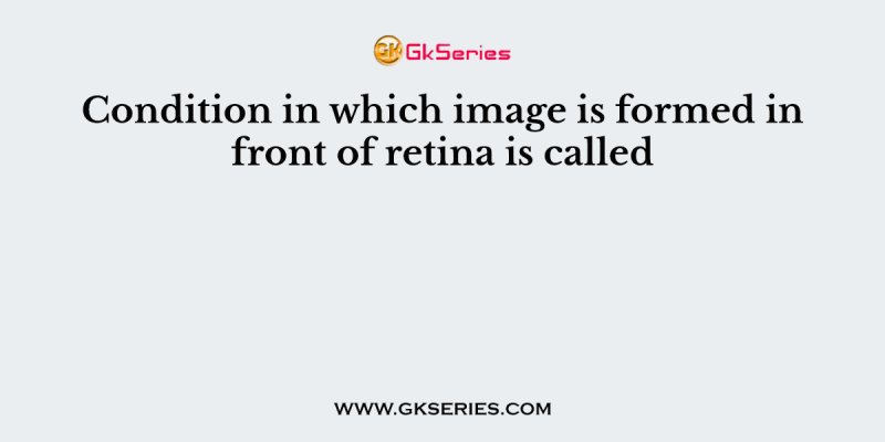 Condition in which image is formed in front of retina is called