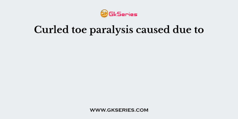Curled toe paralysis caused due to