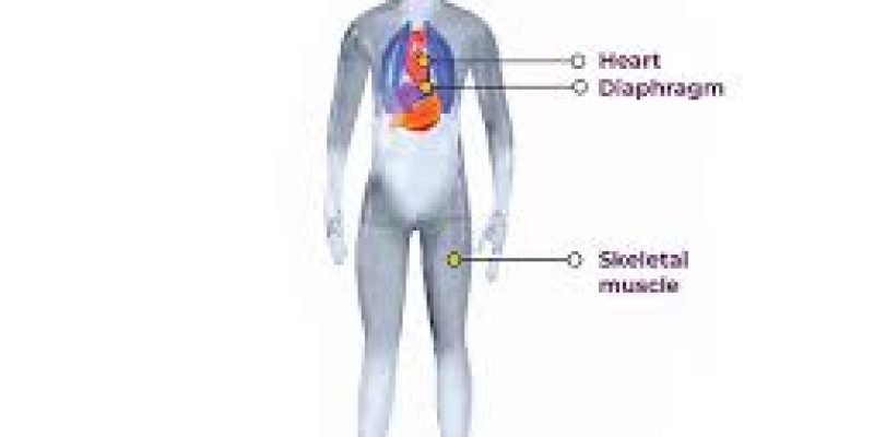 Duchenne Muscular Dystrophy