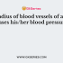 Insufficient blood supply in human body is referred as