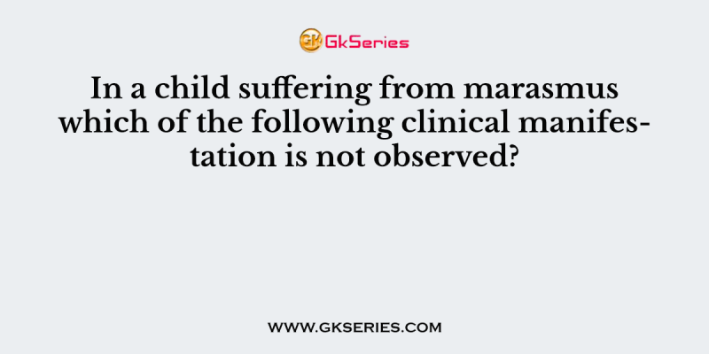 In a child suffering from marasmus which of the following clinical manifestation is not observed?