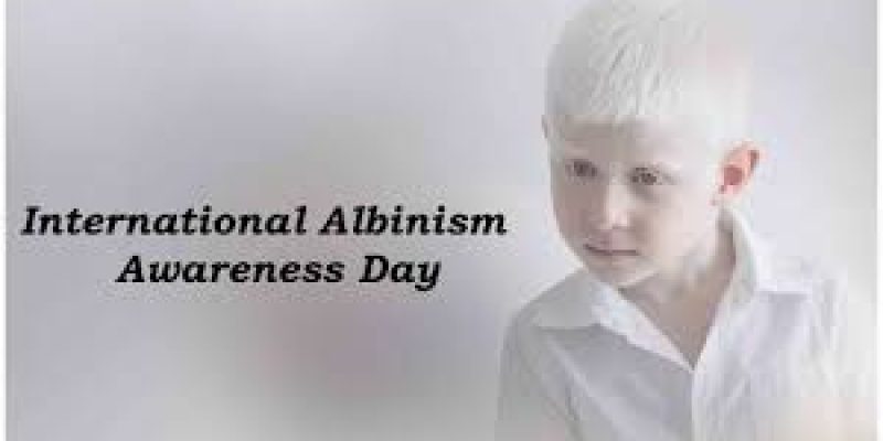 International Albinism Awareness Day 2020