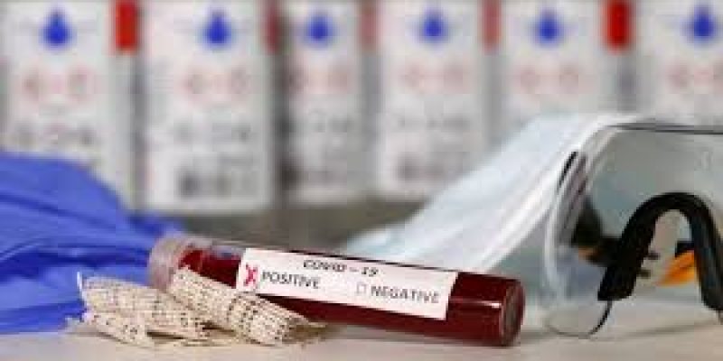 Sero-prevalence study conducted by National Center for Disease Control