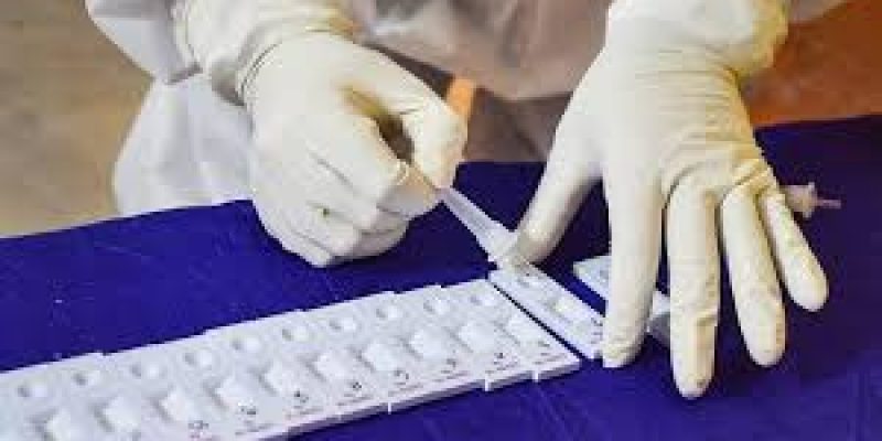 New low-cost novel coronavirus test for the COVID-19